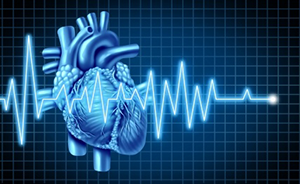 What are some tips to help prepare for a cardiac nuclear stress test?